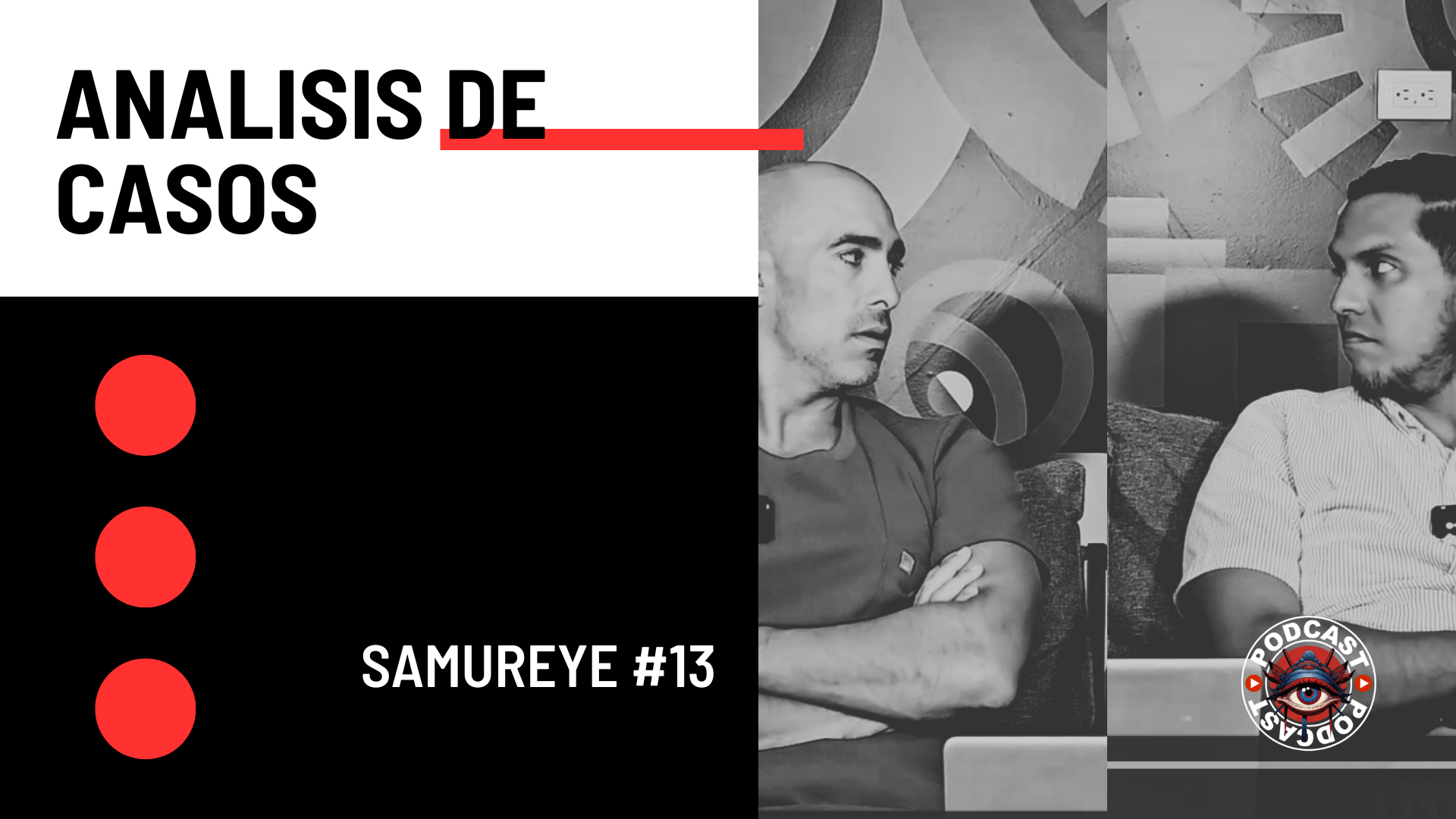 Glaucoma en Ojo Nanoftálmico (Microftalmía): Manejo Triple Lensectomía + Vitrectomía + Ciclofotocoagulación | SamurEye #13